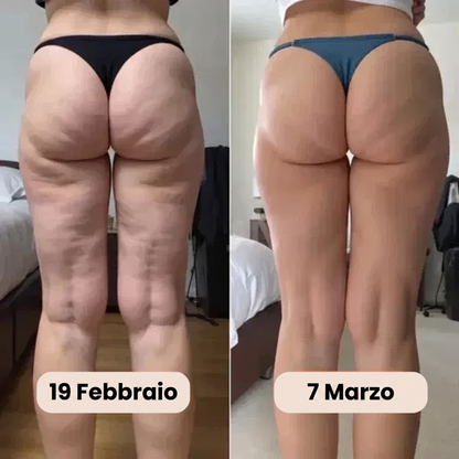 Culotte 3D Anticellulite