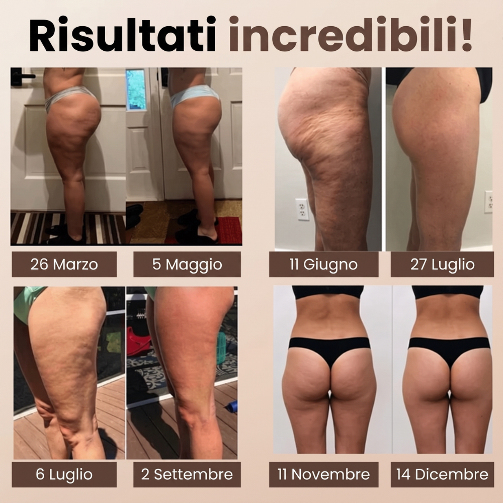 Leggings Corti 3D Anticellulite