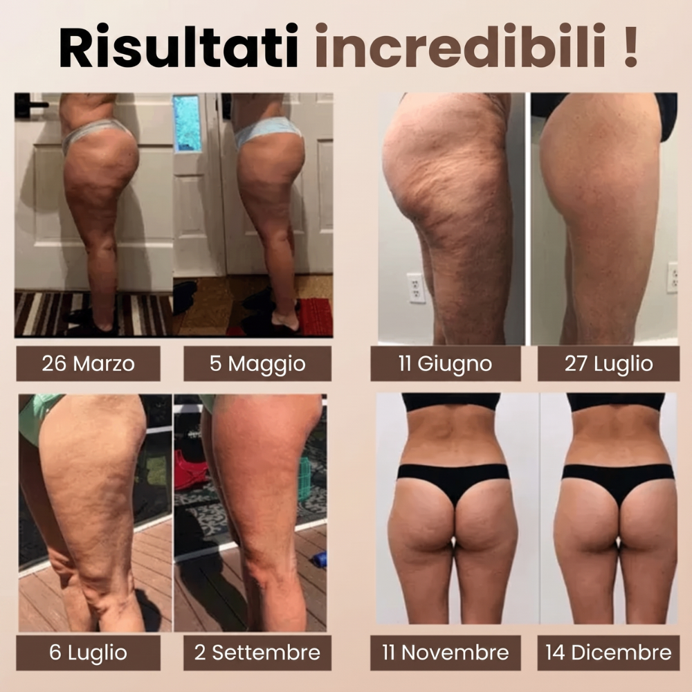 Culotte 3D Anticellulite
